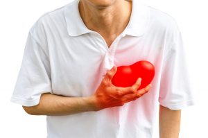 cardiac risk