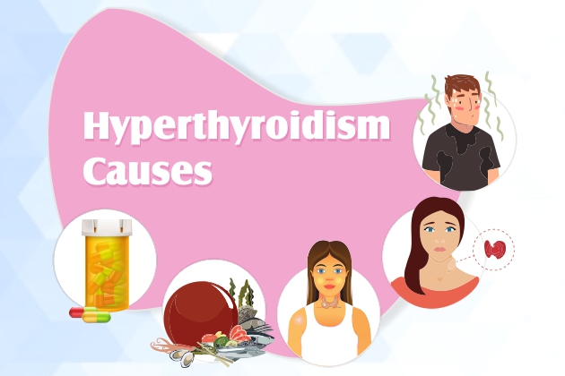 6 Causes Hyperthyroidism All You Need To Know 