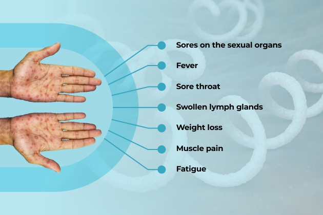 syphilis-is-caused-by-all-you-need-to-know-about-syphillis