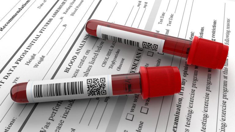 How barcoding eliminates errors How barcoding eliminates errors