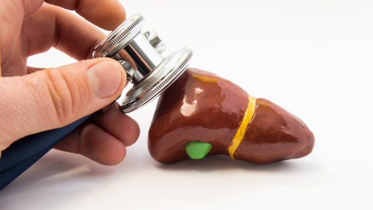 Fatty Liver Demystified Fatty Liver Demystified