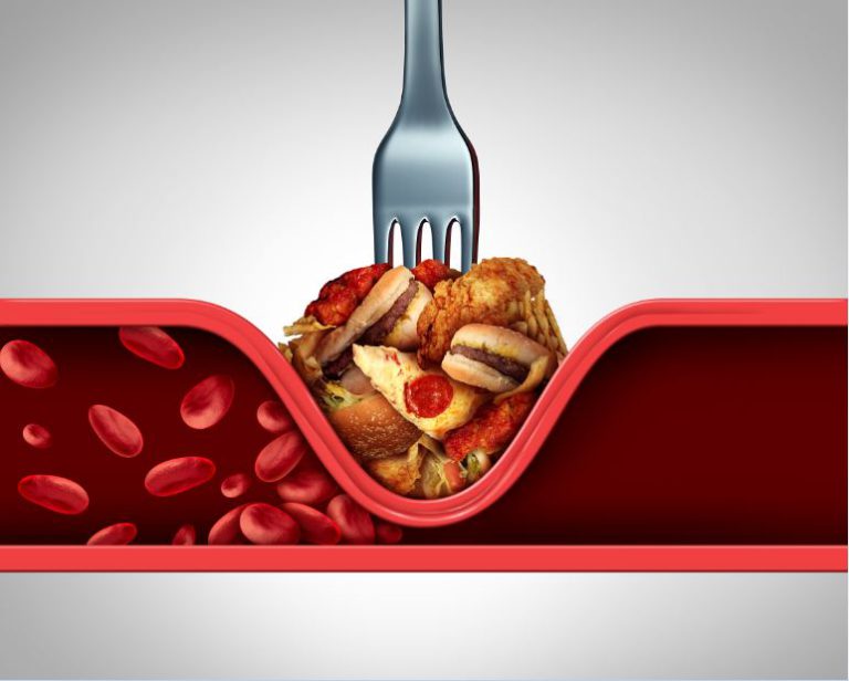 Know now on bad cholesterol- LDL! Know now on bad cholesterol- LDL!