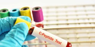 C-PEPTIDE TEST