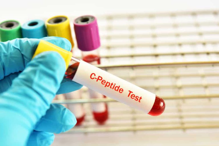 C-PEPTIDE C-PEPTIDE