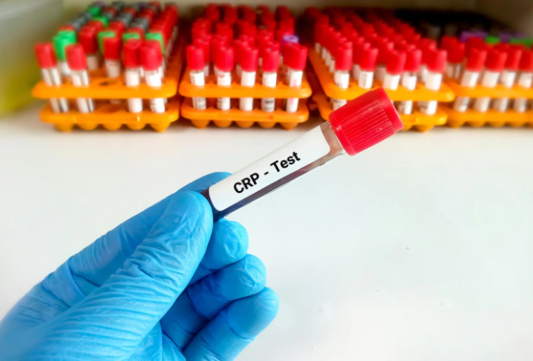 C-REACTIVE PROTEIN (CRP) C-REACTIVE PROTEIN (CRP)