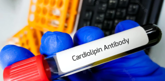 CARDIOLIPIN ANTIBODY