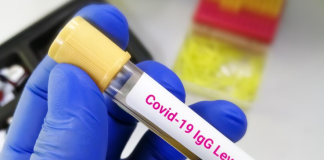 COVID ANTIBODY IGG Test