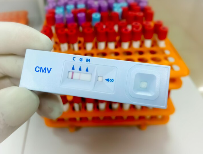 CYTOMEGALO VIRUS Test 1