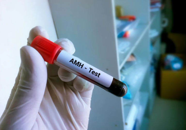 Anti-Mullerian Hormone