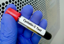 Cystatin C Test