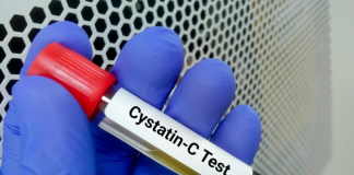 Cystatin C Test