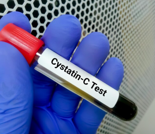 Cystatin C Test