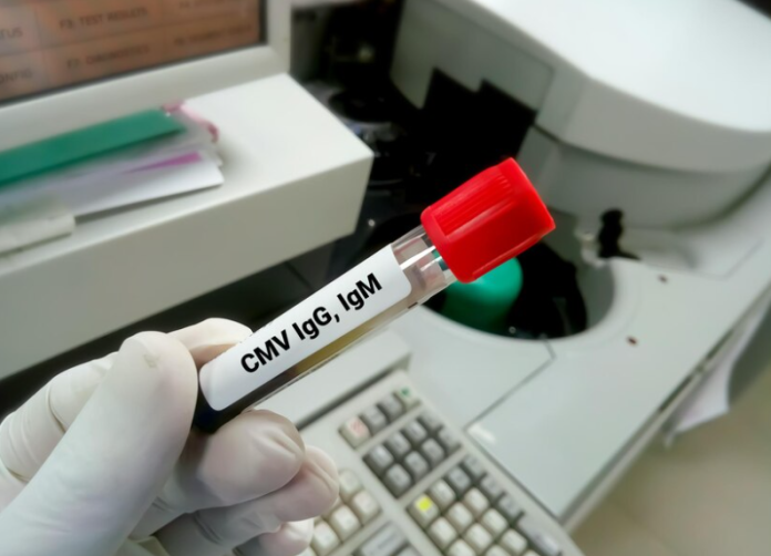 Cytomegalo Virus Test