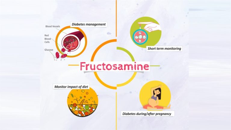 Fructosamin