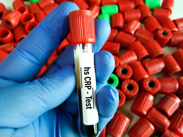 HS-CRP test