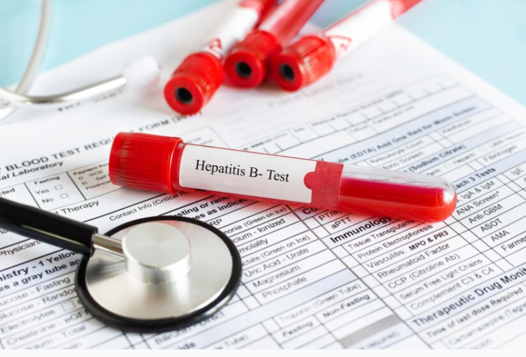 Anti Hepatitis B Core Antigen