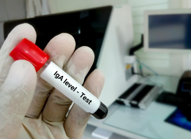 IMMUNOGLOBULIN A (IGA) IMMUNOGLOBULIN A (IGA)