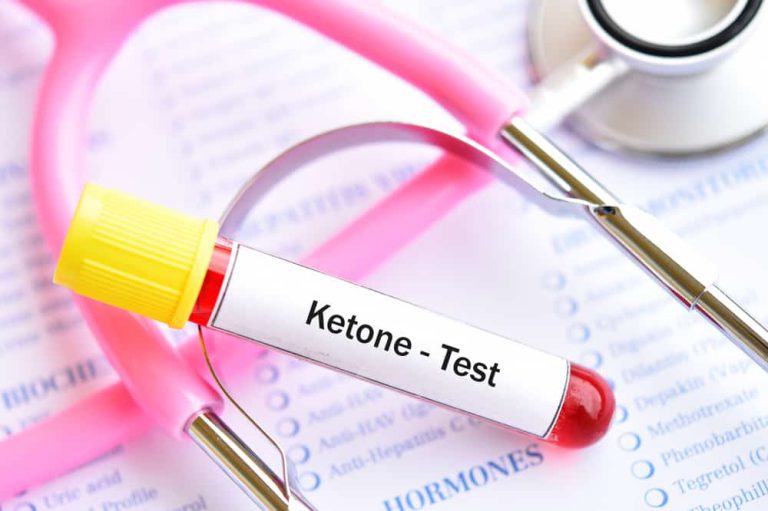 BLOOD KETONE (D3HB) BLOOD KETONE (D3HB)