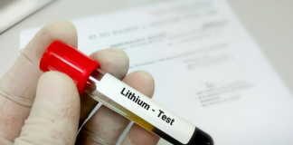 Lithium test