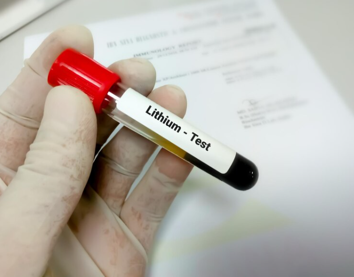 Lithium test