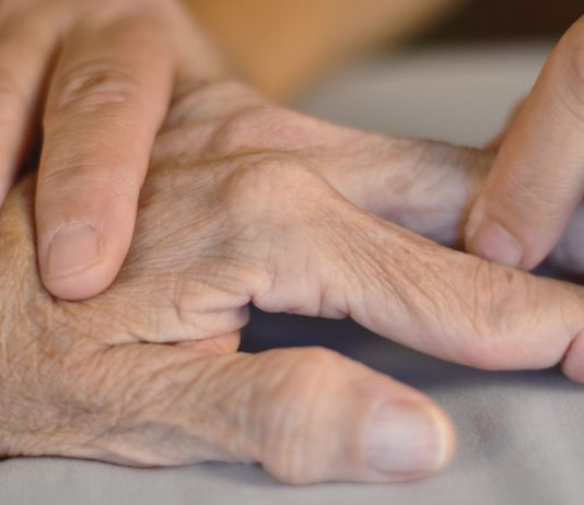 Rheumatoid Arthritis