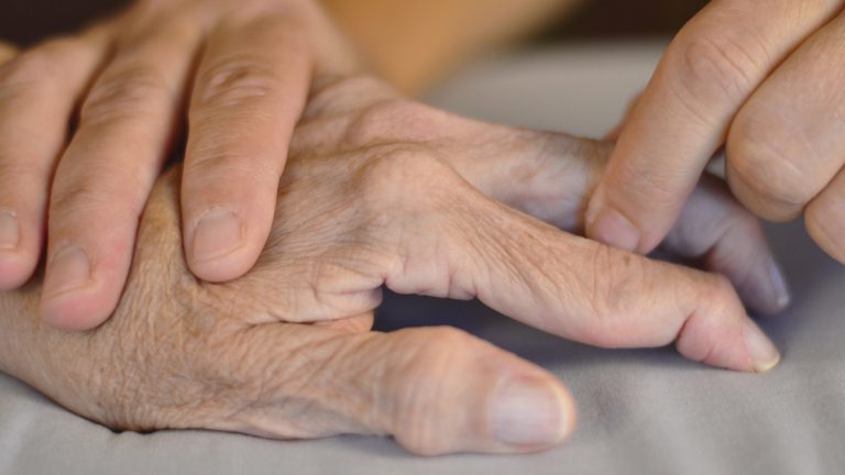 Rheumatoid Arthritis All You Need To Know About Rheumatoid Arthritis All You Need To Know About