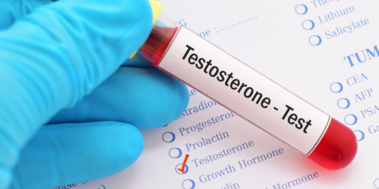 FREE TESTOSTERONE FREE TESTOSTERONE