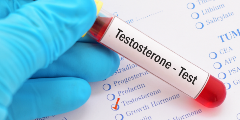 FREE TESTOSTERONE