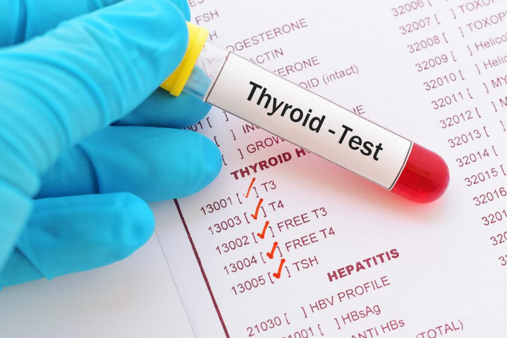 Importance Of Thyroid Test Why You Need Regulor Check Up