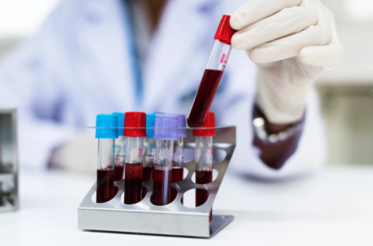 pallidum Hemagglutination Test