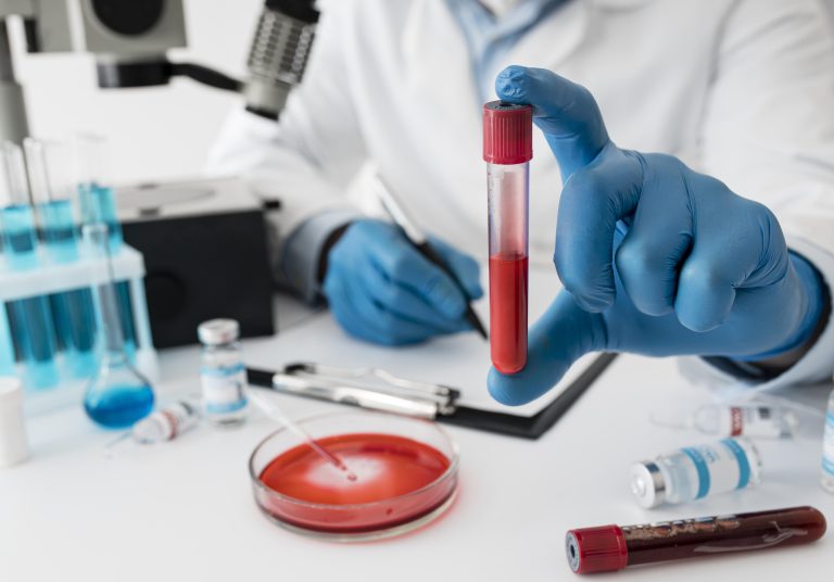 IMMUNOGLOBULIN G (IGG) IMMUNOGLOBULIN G (IGG)