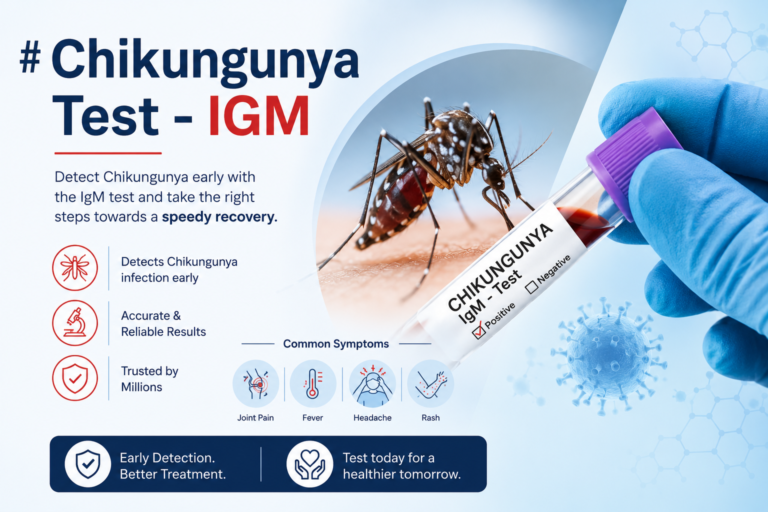 Chikungunya Test – IGM