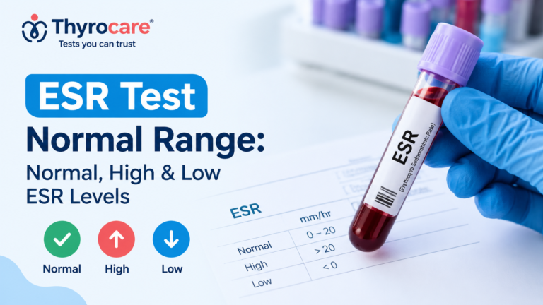 What Do ESR Levels Mean? Understanding Normal, High and Low ESR Levels